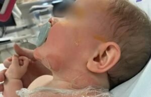 Coorparoo: Imágenes desgarradoras revelan las heridas que sufrió un niño de nueve meses luego de que un extraño le arrojara café hirviendo encima en un parque de Brisbane