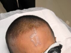 Los matones tatúan un insulto vil en la frente de un niño de diez años