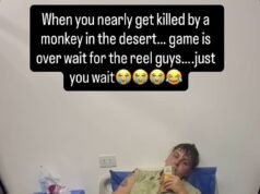 La estrella de Coronation Street fue trasladada de urgencia al hospital después de un extraño ataque de mono durante unas vacaciones familiares