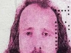 En la foto: hombre británico de 36 años que murió después de un trasplante de cabello y un tratamiento dental en Turquía.