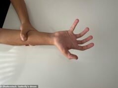 Sufrí una de las enfermedades más raras del mundo… sólo 50 personas han sido diagnosticadas con ella.