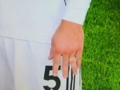 La estrella del Fulham sufre una lesión GRUESA tan grave que no puede mirar mientras los médicos colocan el hueso en su lugar