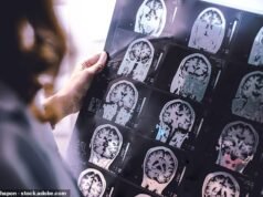 Tratamiento para la demencia que cambiará la vida ‘en cinco años’: cura posible, anuncian expertos