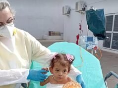 La gemela siamesa que sobrevivió a una operación maratónica para separarla de su hermana muere pocos meses después en Brasil