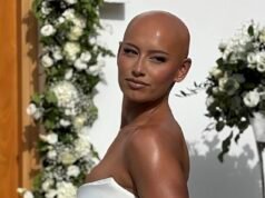 La novia calva que perdió el cabello a causa de la alopecia a los dos años muestra su cuero cabelludo desnudo por primera vez el día de su boda y dice: “Nunca me he sentido más hermosa”