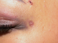 Joven agredida por su ex dice que el guardia de seguridad fue negligente: ‘¿Ves a una mujer que le dan una patada en la cara y todavía pregunta si va a llamar a la policía?’